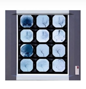 ECOMED Professional LED Medical Film Viewer