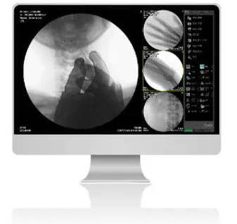 ZENIS Software